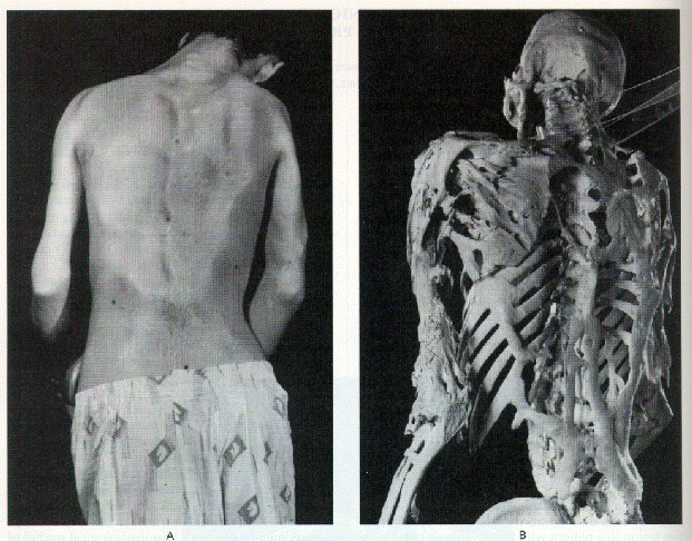 The World's Strangest Diseases