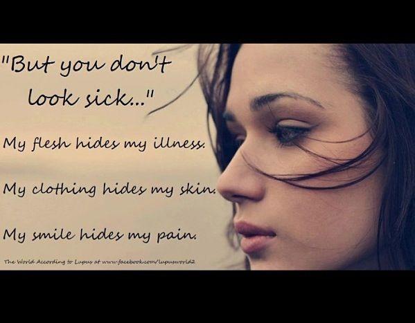 Autoimmune Disease: What You See Is NOT Always What You Get