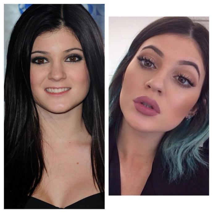 Is Kylie Jenner becoming too fake?