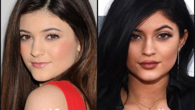 Is Kylie Jenner becoming too fake?