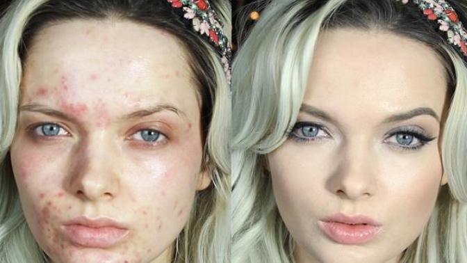 Women false advertising