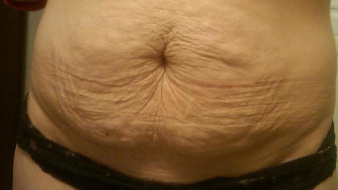 There is no such thing as the Dad bod!