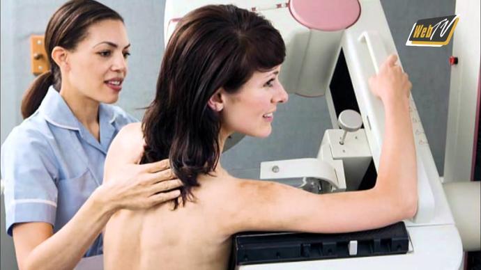 Mammograms: Basic Information and 10 Things You Should Know