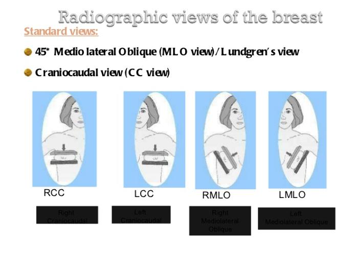 10 Things You Should Know Before Your First (or Next) Mammogram (Part 1)