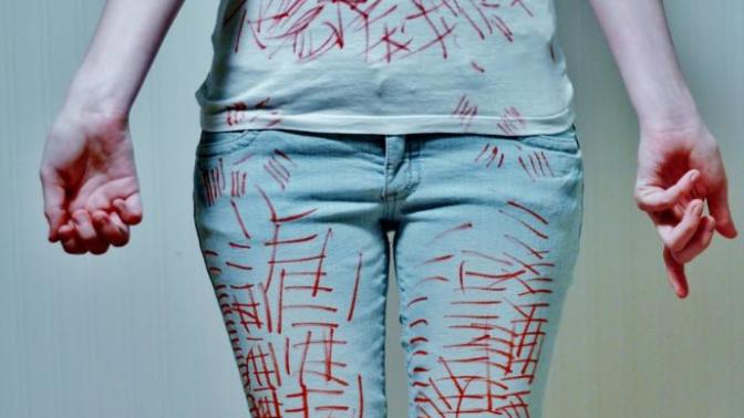 Self Harm - My Take, My Story