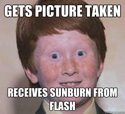 The Struggles Of A Pale Person