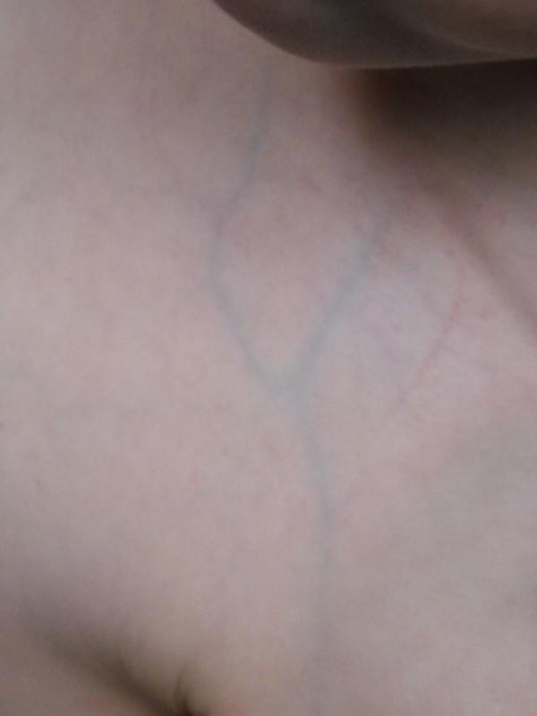 The Struggles Of A Pale Person