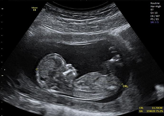 PregTeen: I want to share my happiness and I DO NOT REGRET BEING PREGNANT.