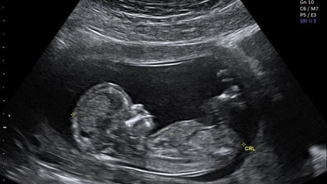 PregTeen: I Want To Share My Happiness And I DO NOT REGRET BEING PREGNANT.