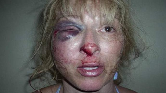 When Is It Okay To Slap Your Partner?