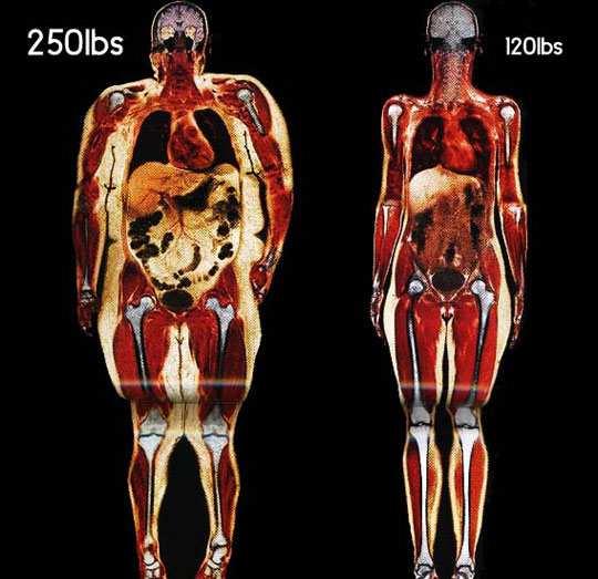 It's not fat shaming it's science. Slimmer women are more biologically more appealing to both males and females.