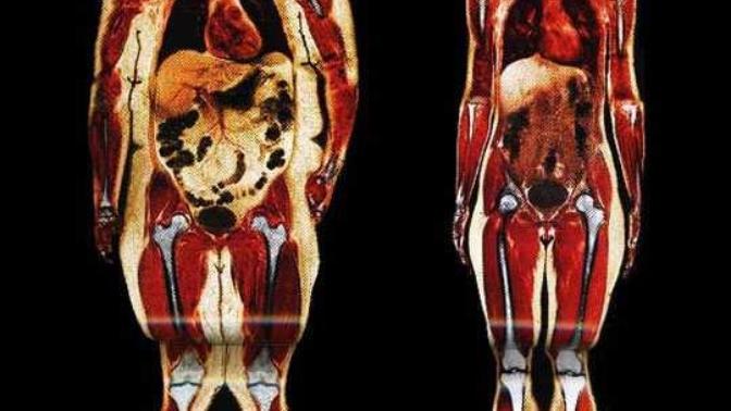It's Not Fat Shaming, It's Science: Slimmer Women Are More Biologically Appealing