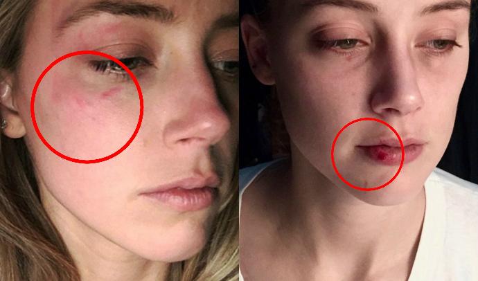 Johnny Depp and Amber Heard Divorce Debacle