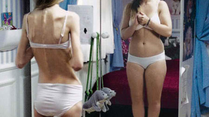 Dying to be Thin: My Struggle With Eating Disorders