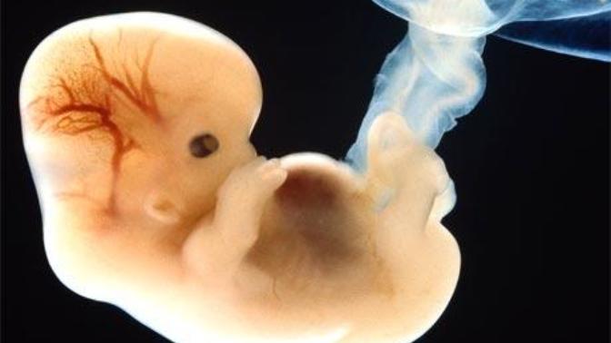 Why Abortion Will Always Be Murder