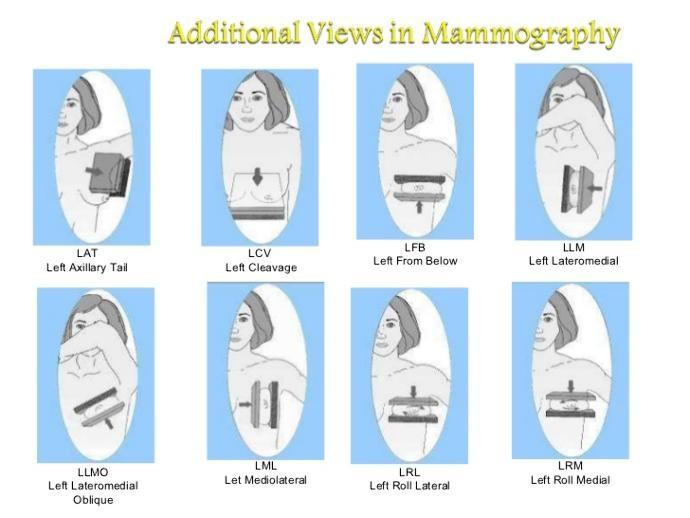 10 Things You Should Know Before Your First (or Next) Mammogram (Part 2)