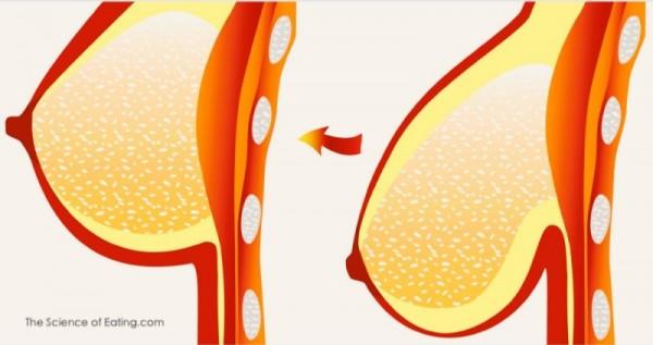 6 Cons Of Having Big Breasts
