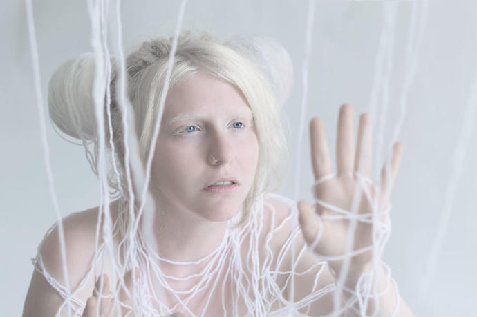 50 Shades Of White: The Beauty Of Albino People