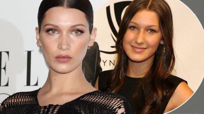 Bella Hadid's Plastic Insecurities - Why You Should Love Yourself As You Are
