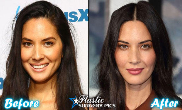 Olivia Munn's Ever Changing Face