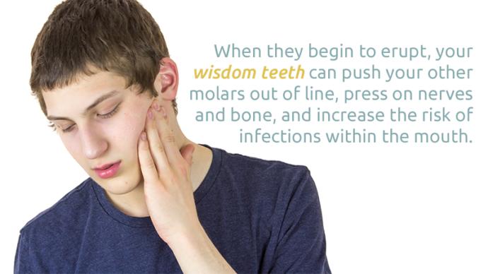 4 Reasons to Remove Your Wisdom Teeth!