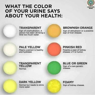 What The Colour of Your Urine Says about your health