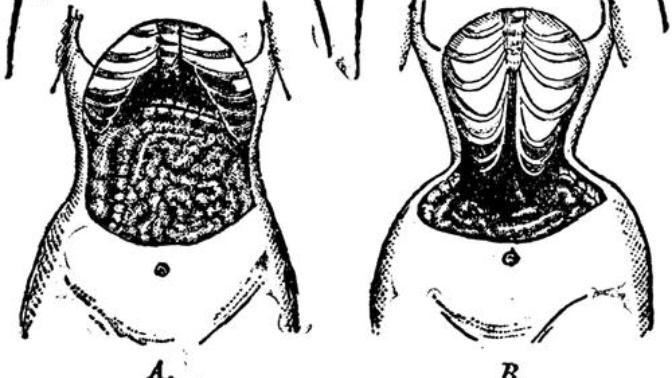 The Dangers of Waist Training