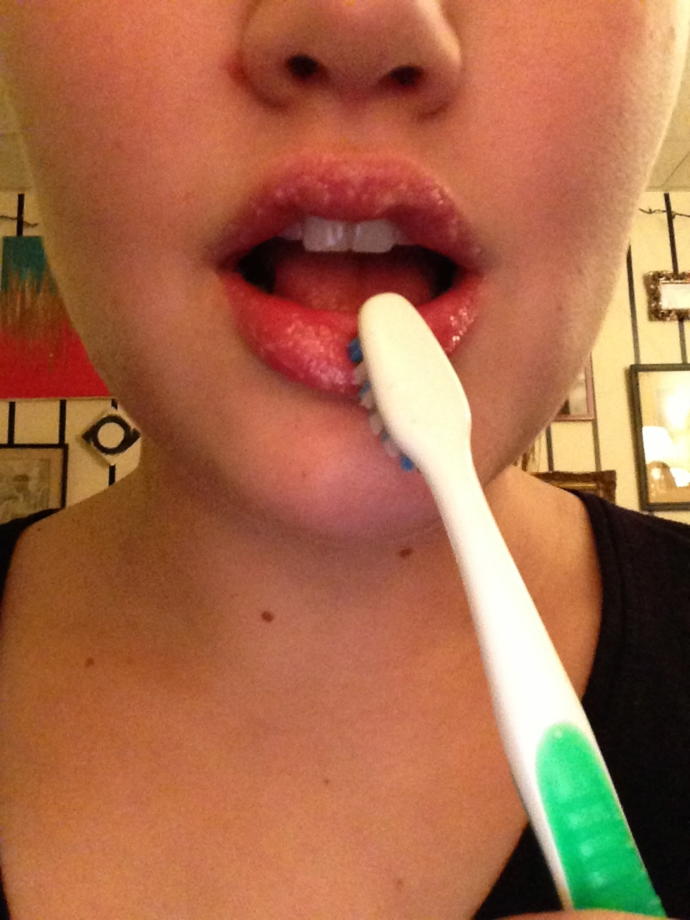 Full Lips are not A Dream Anymore!