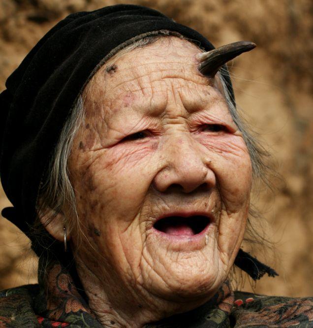 These Creepy Diseases Will Freak You Out!
