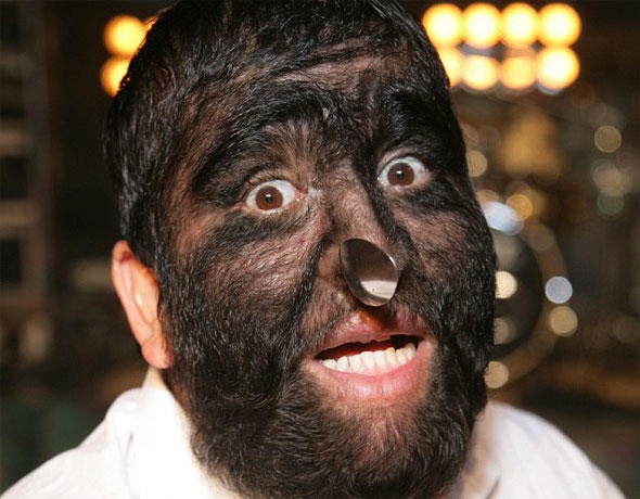 These Creepy Diseases Will Freak You Out!