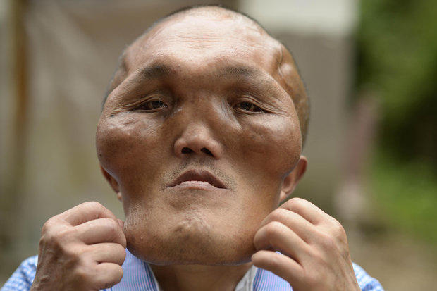 These Creepy Diseases Will Freak You Out!