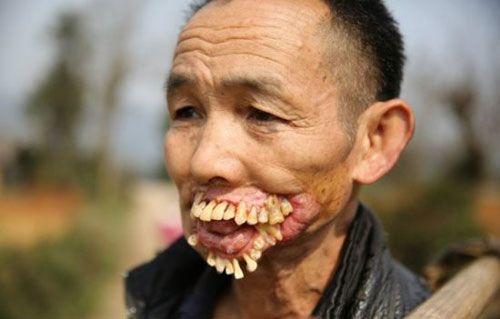 5 Scariest Diseases in the World