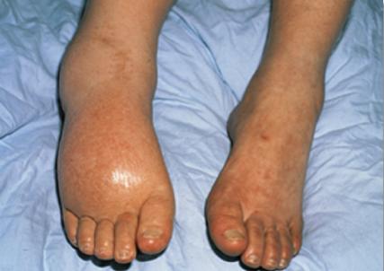 5 Scariest Diseases in the World