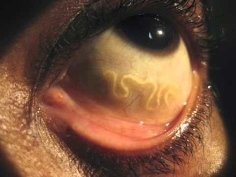 5 Scariest Diseases in the World