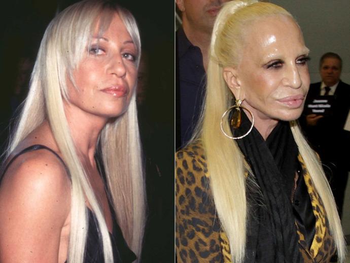 Shocking Plastic Surgery Fails That You Won't Believe