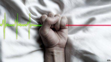 Should Euthanasia Be Legal?