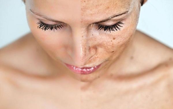 How to Deal with Sensitive Skin