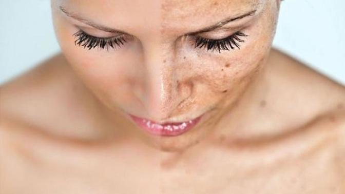 How to Deal with Sensitive Skin