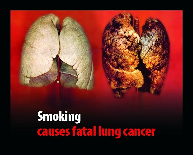 Cancer Prevention: Tips to Reduce Your Risk!