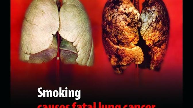 Cancer Prevention: Tips to Reduce Your Risk!