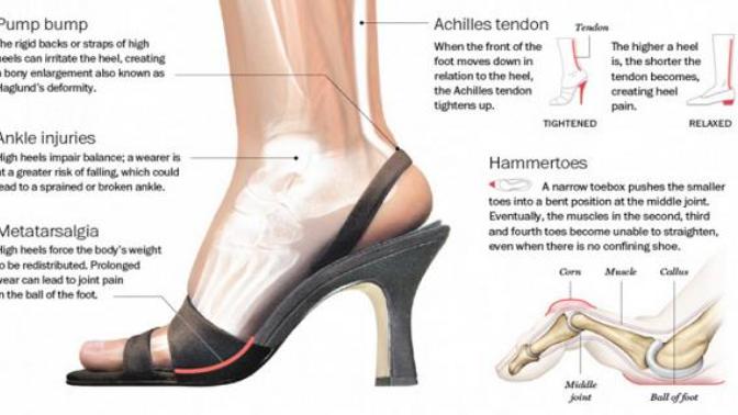 The Real Harm in High Heels: How High Heels Affect Your Body?