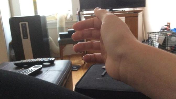 The anxiety you feel before surgery