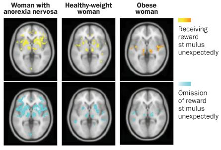 Losing Weight and ED – How to Diet After Eating Disorders