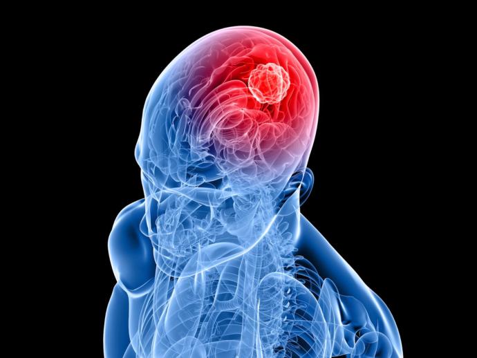 The Mental Tumor Called Bitterness