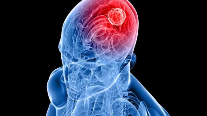 The Mental Tumor Called Bitterness