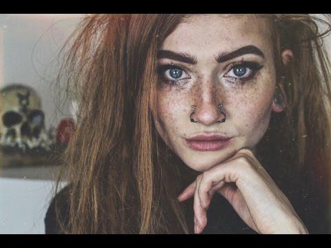 Freckles Serve a Purpose - Find Out What That Purpose Is
