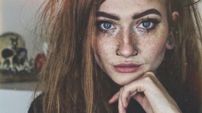 Freckles Serve a Purpose - Find Out What That Purpose Is