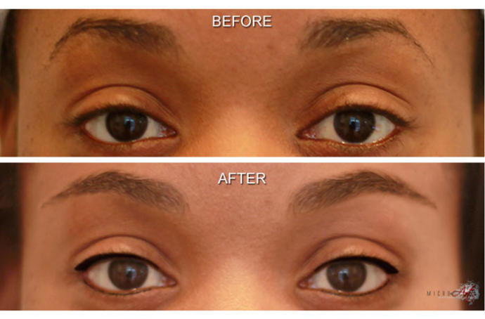 Cosmetic Makeup Tattoos