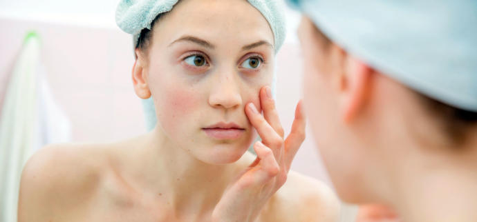How to Get Rid of Dark Circles