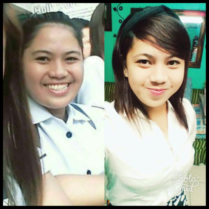 Why I Am Against Fat Acceptance